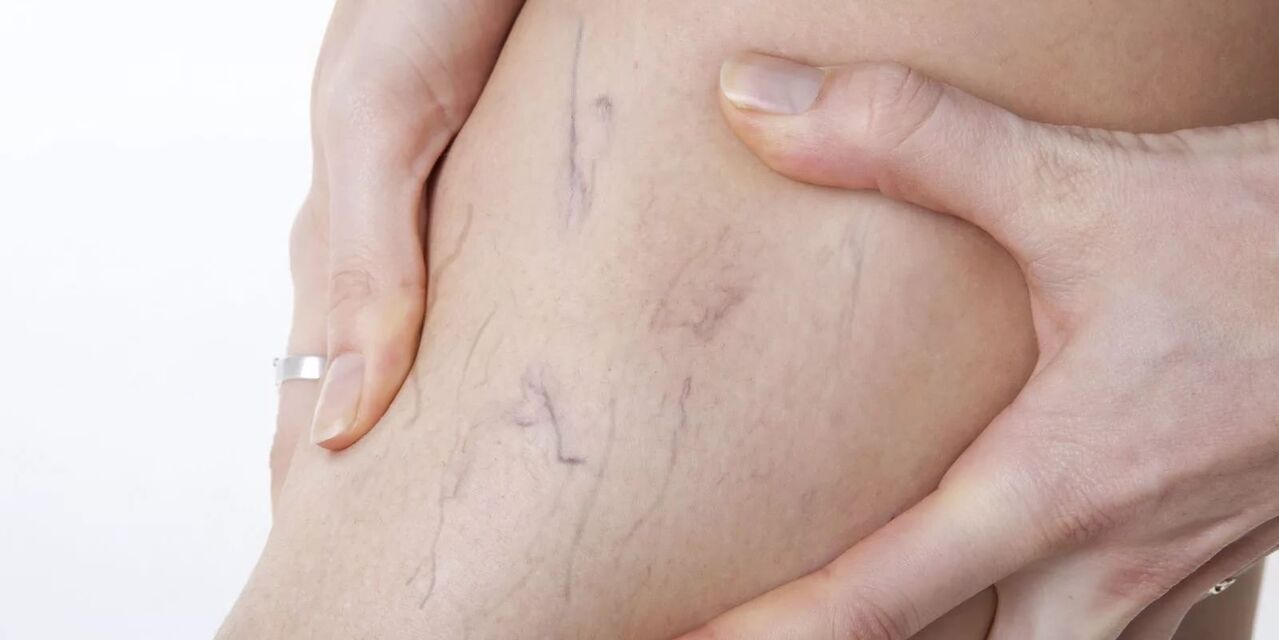 Przed użyciem kremu żylonowego