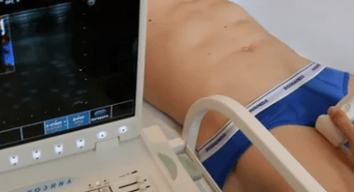 Opcje diagnostyczne żylaków kończyn dolnych